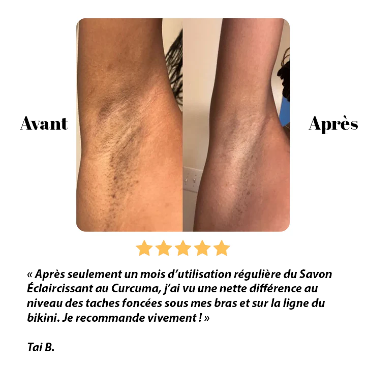 Savon éclaircissant au curcuma, citron et à l'acide kojique